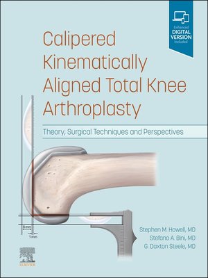 cover image of Calipered Kinematically aligned Total Knee Arthroplasty E-Book